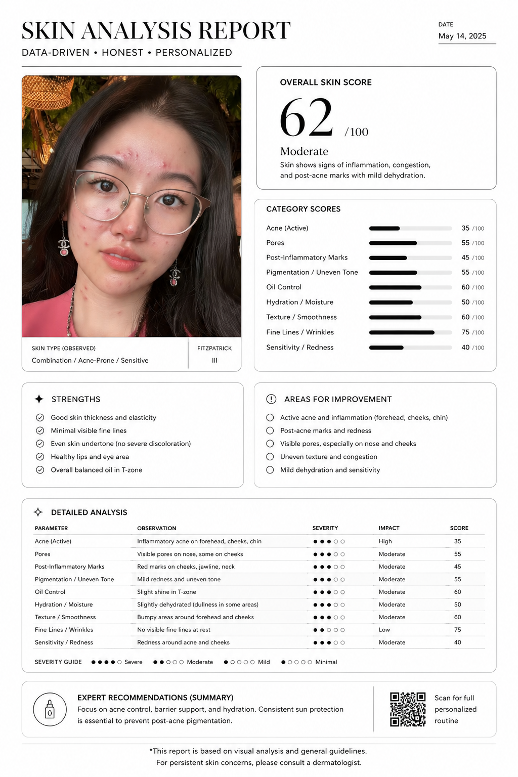 Skin Analysis Report